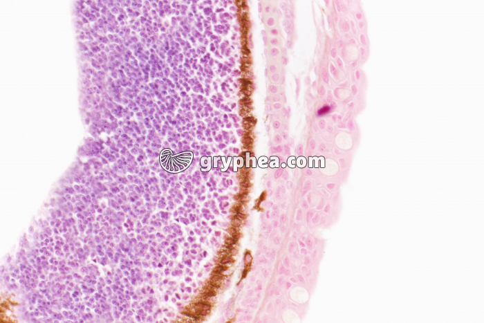 Mélanocytes de Poisson x100 - gryphea.com